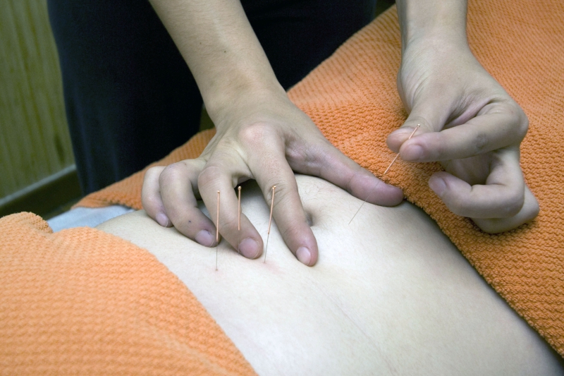 osteopathe-ST MANDRIER SUR MER-min_acupuncture-4175625